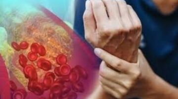 أطعمة تطرد الكوليسترول من الجسم – الجريدة