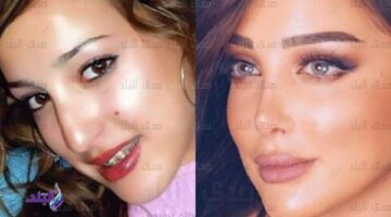 بعد شن الهجوم عليها.. صور طليقة تامر حسني وتغير ملامحها – الجريدة