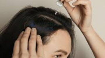 طرق علاج الثعلبة بالزيوت الطبيعية والدواء.. تعرف عليها – الجريدة