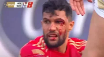 الأهلي يُعد قناعًا مؤقتًا ليحيى عطية الله لحين تصميم قناع خاص به – الجريدة