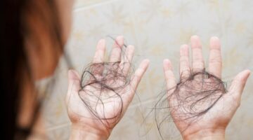 5 فيتامينات مهمة لنمو الشعر.. أنواع يمكنها تقوية البصيلات ومنع التساقط – الجريدة