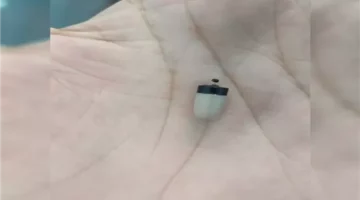 طبيب أنف وأذن بأسيوط ينتقد غش الطلاب: جالي العيادة 6 طلاب ثانوية عامة