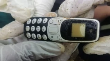 استخراج هاتف محمول من بطن شاب مصري بعد عامين من ابتلاعه